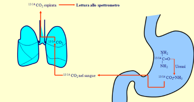 Il cavo orale sorgente di alitosi in presenza di Helicobacter pylori?