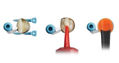 Dentsply Sirona lancia Surefil one: un nuovo composito rivoluzionario