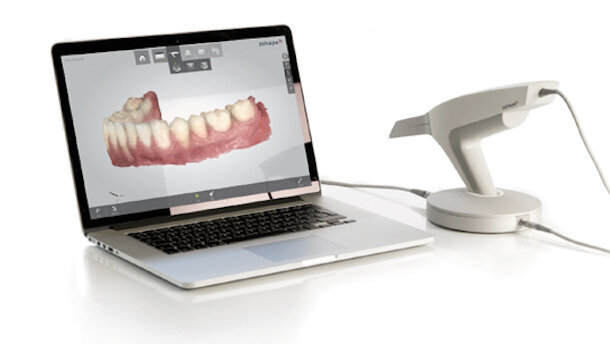 3Shape, flujo digital completo para restauraciones