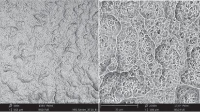 Implantes MIS destacam-se em estudo comparativo de implante de superfície
