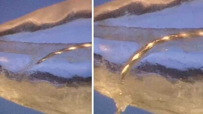 Control the anatomy; control procedural training Control the anatomy; control procedural training