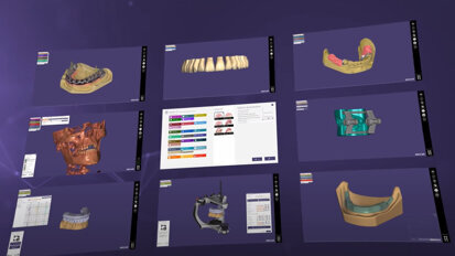 exocad – DentalCAD 2.4 Plovdiv (beyond Full Denture)