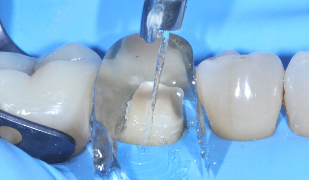 Fig. 16: Thorough rinsing. 