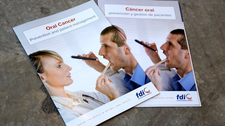 Sunstar supports release of chairside guide on prevention and treatment of oral cancer