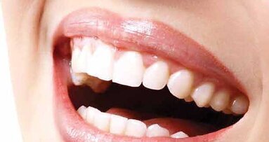 The dentist and the technician: A love story about breaking up with traditional methods