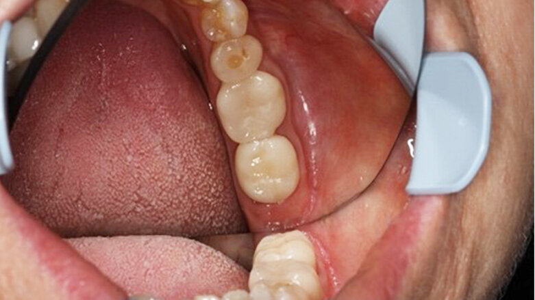 Scan perfectly with CEREC Primescan, and gain time for what is really important: your patients