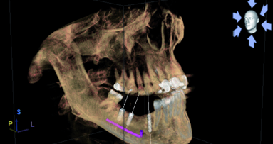 The 3-D difference: CBCT diagnostics to enhance treatment—Part 1