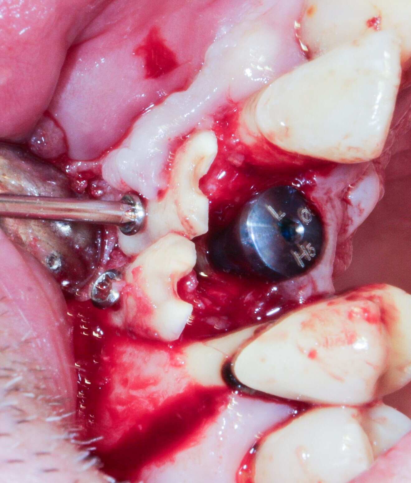 Fig. 2: Radicular grafts are polarised.