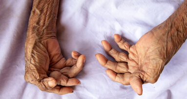 Rheumatoid arthritis patients rate how oral health affects quality of life