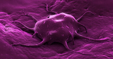 Des bactéries inoffensives vivant dans le sol, tuent le cancer avec succès