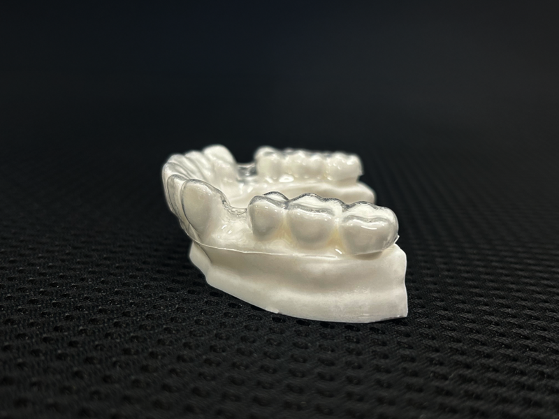 Fig. 13e: The thermoformed PETG aligner has uneven aligner thickness between the anterior and posterior.