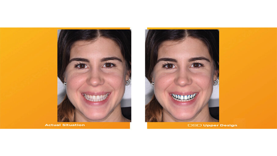 Fig. 9_Pre-visualizzazione.