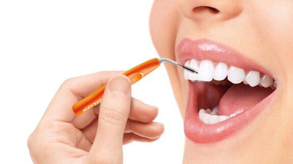La higiene interdental en el cuidado de los implantes