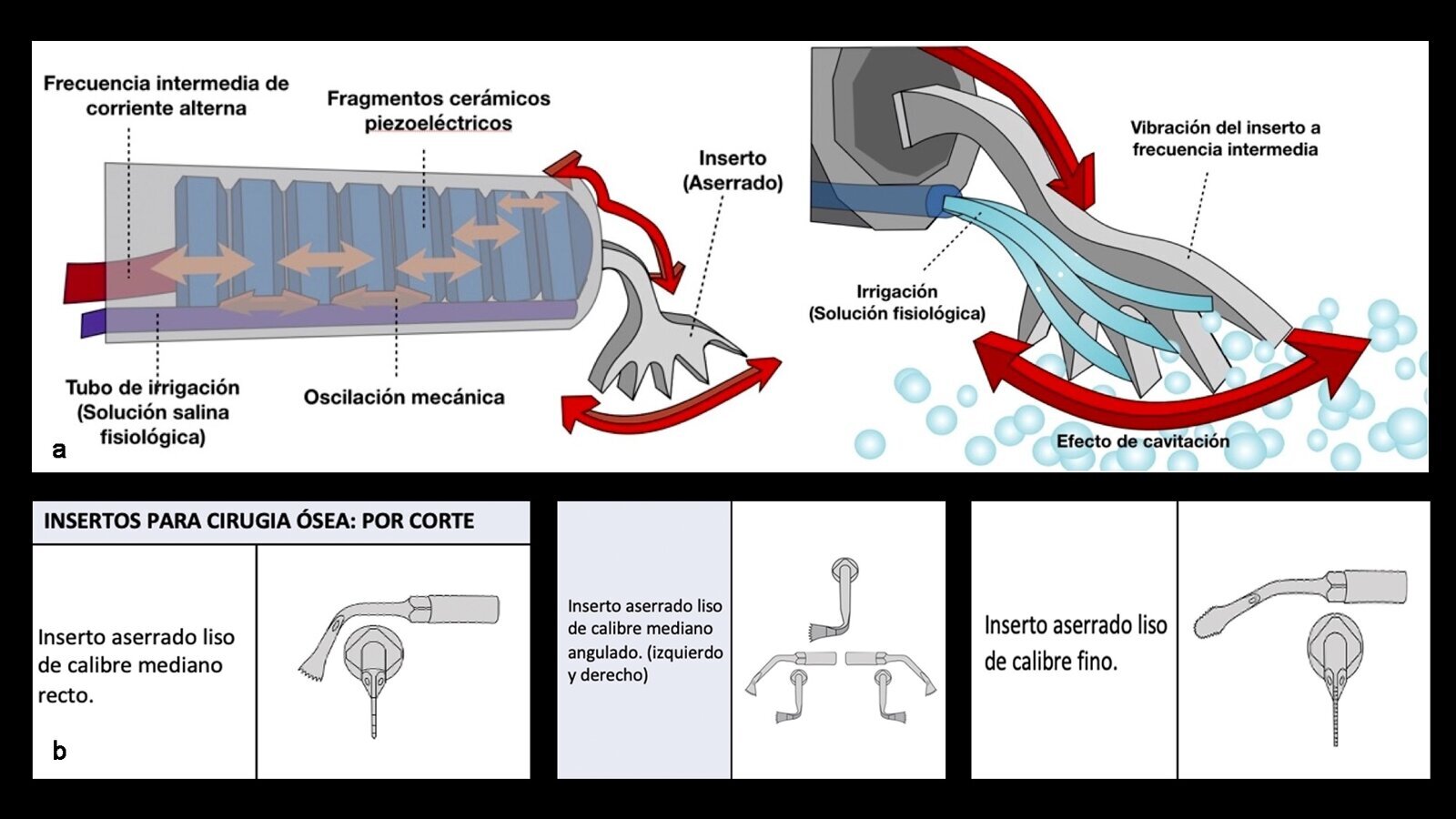 Piezocirugía  (4). Principios generales de la tecnología piezoeléctrica
