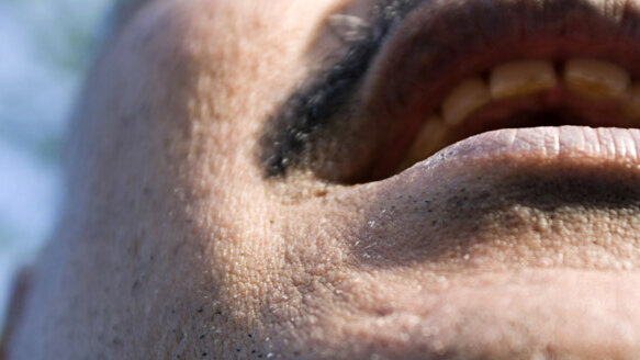 California Dental Association recommends oral cancer screening