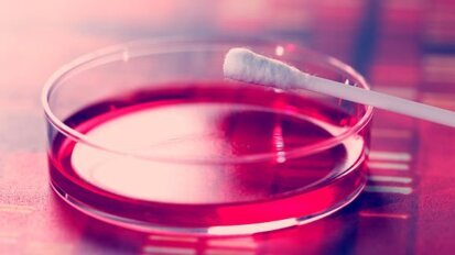 新的唾液检测能够预测人乳头状瘤病毒相关癌症的复发