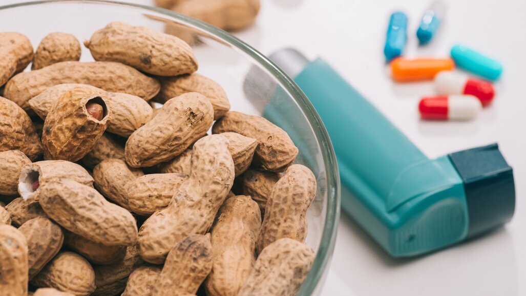 Onderzoekers ontwikkelen speciale tandpasta voor de behandeling van pinda-allergie