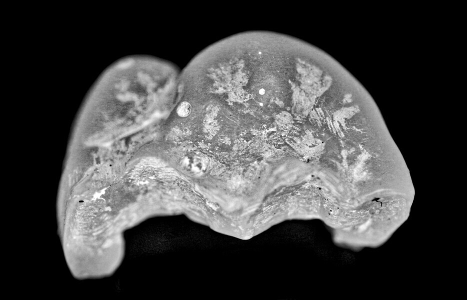 Fig. 2: Provisional restoration.