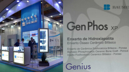Baumer atua no combate à perda óssea