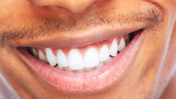 Auch hinter Gittern weiße Zähne