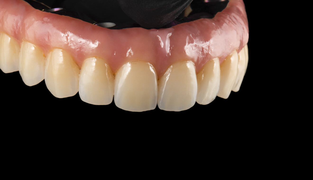 Fig. 12b: Result after glazing, shown from angled view.