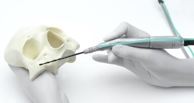 Una solución única para implantes cigomáticos