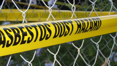 L’amianto può essere dannoso anche per gli stessi dentisti