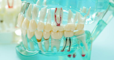 Endodontic training: Study calls for standardisation, modernisation