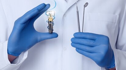 Digital workflows for conversion prostheses in full-arch implant dentistry