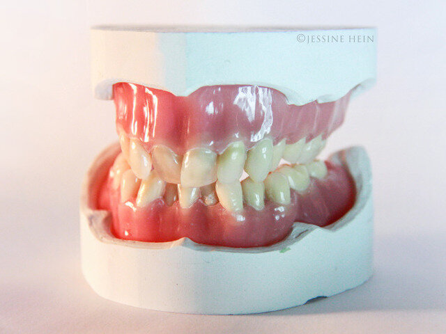 Hand-sculpted recreation of David Bowie's natural teeth.