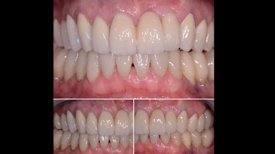 Fig. 11 - Situazione a 5 anni.