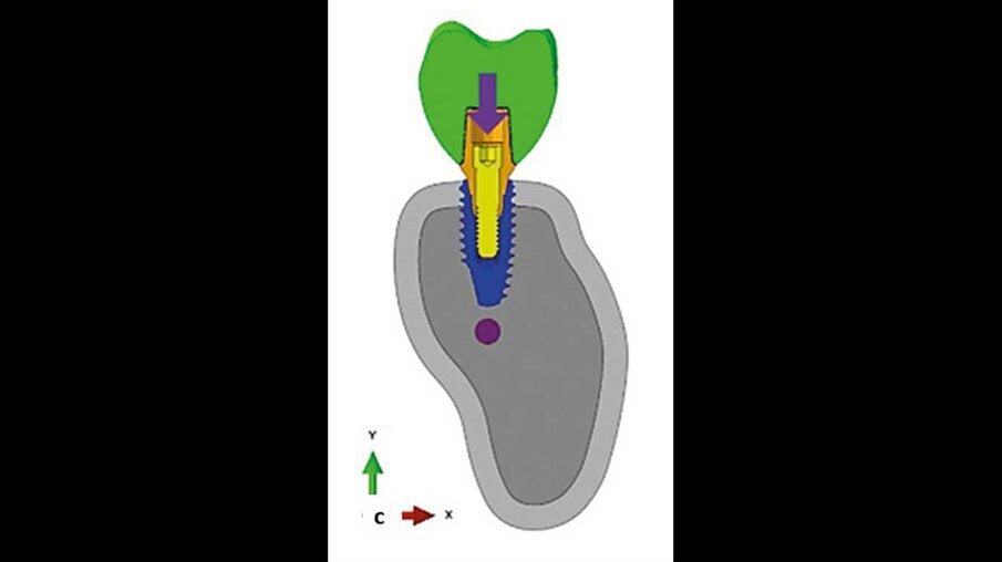 Fig. 7c_Modello 3D studiato nel FEM.