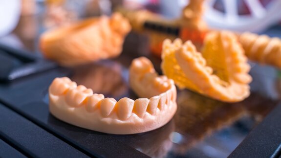 Same-day 3D-printed restorations—taking chairside 3D printing to the next level