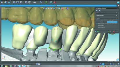 Adaptation of traditional working methods to the creation of Cr-Co ceramic restoration with CAD/CAM technology Adaptation of traditional working methods to the creation of Cr-Co ceramic restoration with CAD/CAM technology