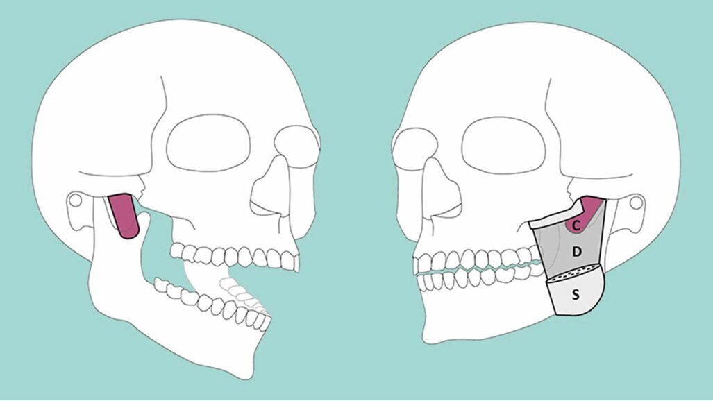 Neue Muskelschicht am Kiefer entdeckt