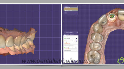 Estetska zona i estetski senzibilitet – želje i mogućnosti - PRVI DEO