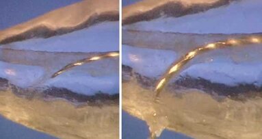 Control the anatomy; control procedural training