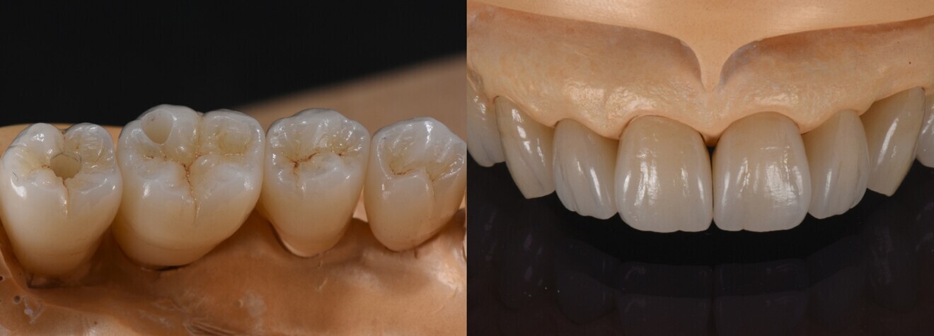 Figs. 8a & b: For a natural shine, I set the accents with staining and glazing.