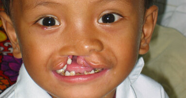 Times of crisis bring new plans for craniofacial medical care