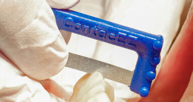 Excellence made easy: A Story of ContacEZ innovation