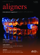 aligners international No. 1, 2025 aligners international No. 1, 2025