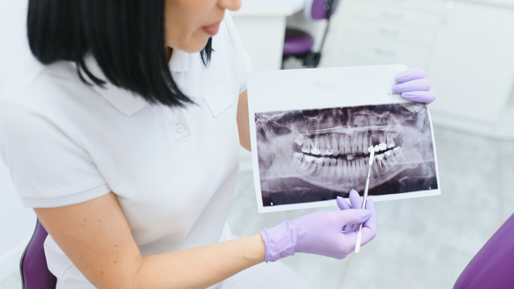 JO 2023 : tout est son contraire, l’évolution des paradigmes