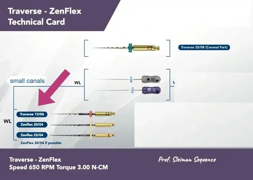 Фиг. 5 Последователността на оформяне на Sleiman, използваща пилите на Traverse и ZenFlex. 