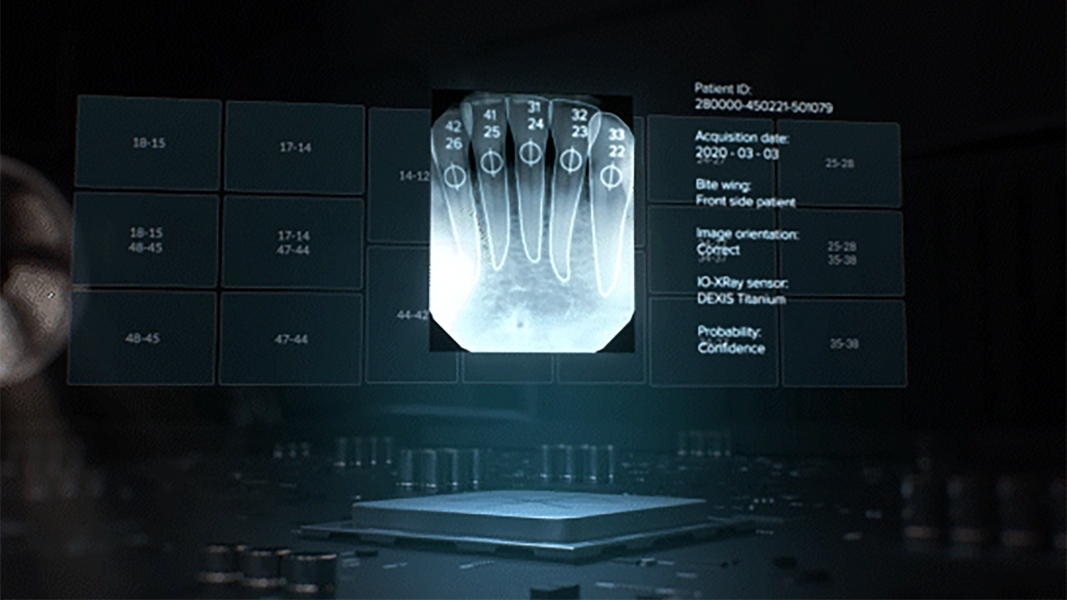 MagicSort-Funktion in DTX. © DEXIS