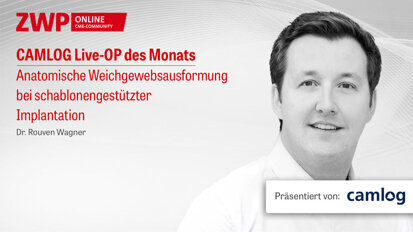 1 CME-Punkt: CAMLOG Live-OP im Archiv abrufbar 1 CME-Punkt: CAMLOG Live-OP im Archiv abrufbar