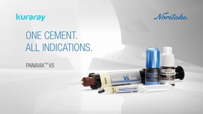 Kuraray Noritake – PANAVIA V5 Kuraray Noritake – PANAVIA V5