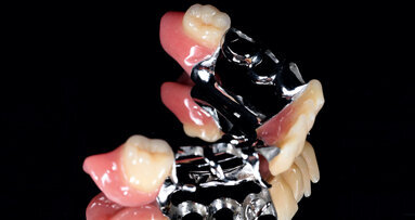 Cherry on top in complete denture prosthetics: individuality and naturalness