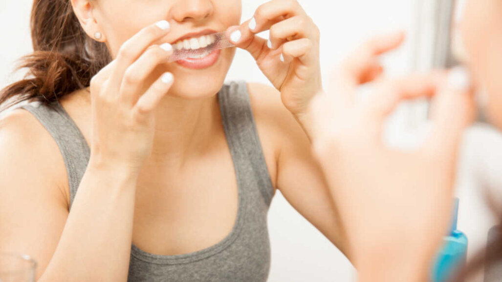 Produtos de clareamento dentário podem danificar o tecido dentinário