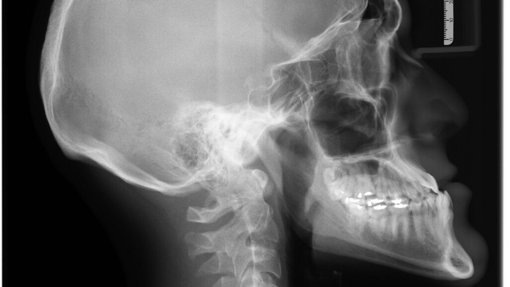 Obrazowanie 2D w stomatologii – kurs dla lekarzy dentystów