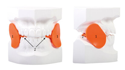 La recidiva in ortodonzia